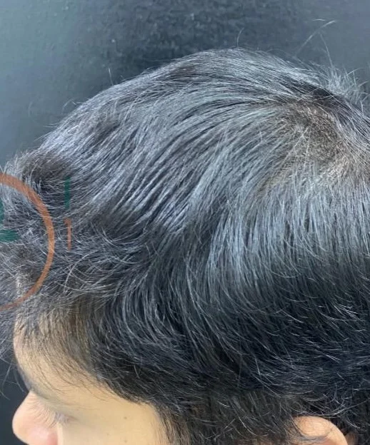 After treatment result 2