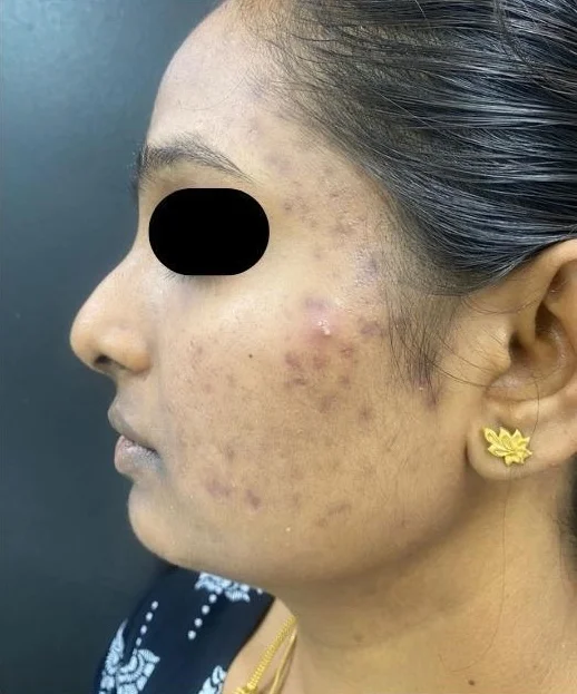 After treatment result 4