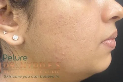 After treatment result 3