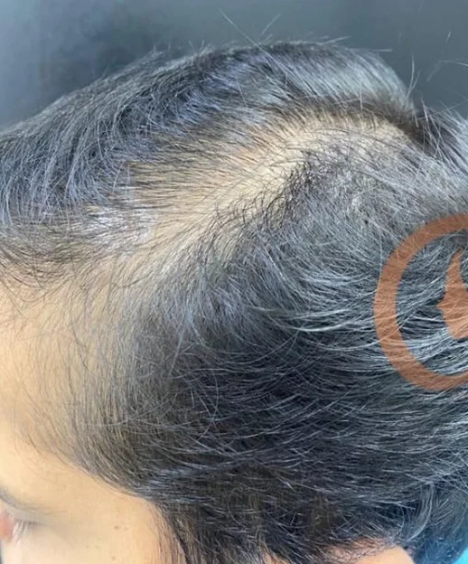 Before treatment 2