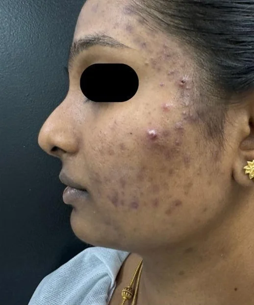 Before treatment 4