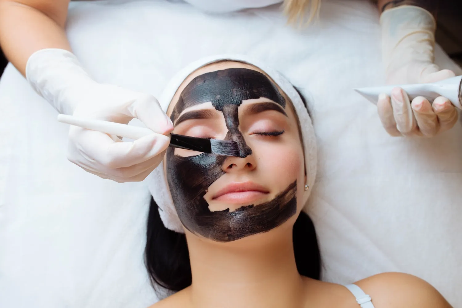 Carbon Laser Peel (Hollywood Peel)