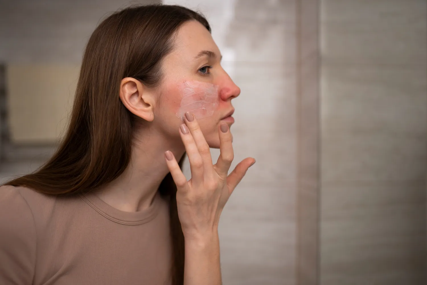 Lichen Planus