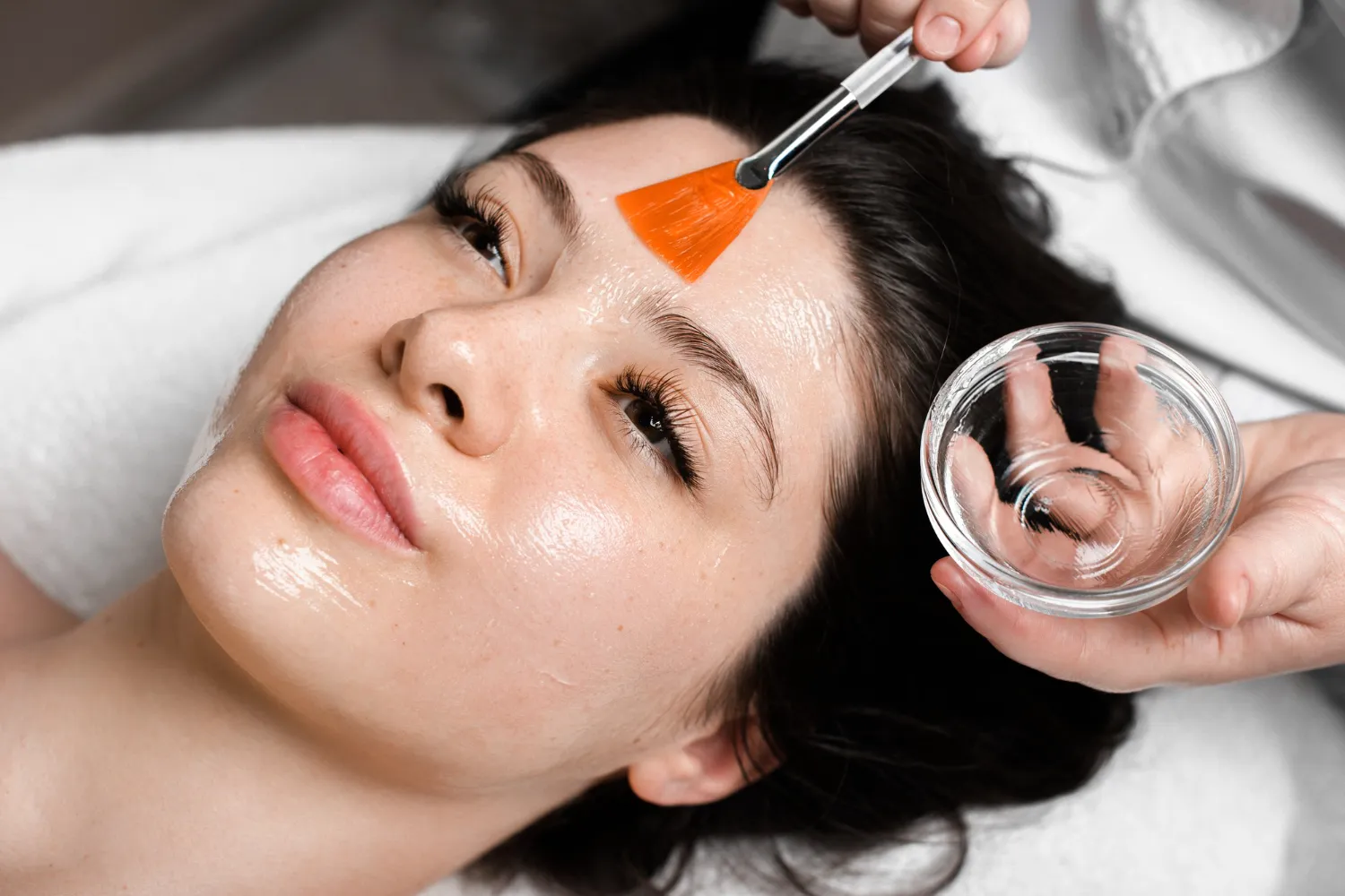 Brightening Chemical Peels